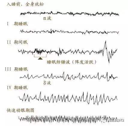 长寿秘诀竟是睡觉(长寿人睡觉的三个特征)